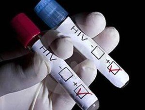 parejas-infectadas-con-el-VIH